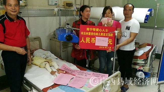 广西县促会筹善款救助玉林重大烫伤儿童